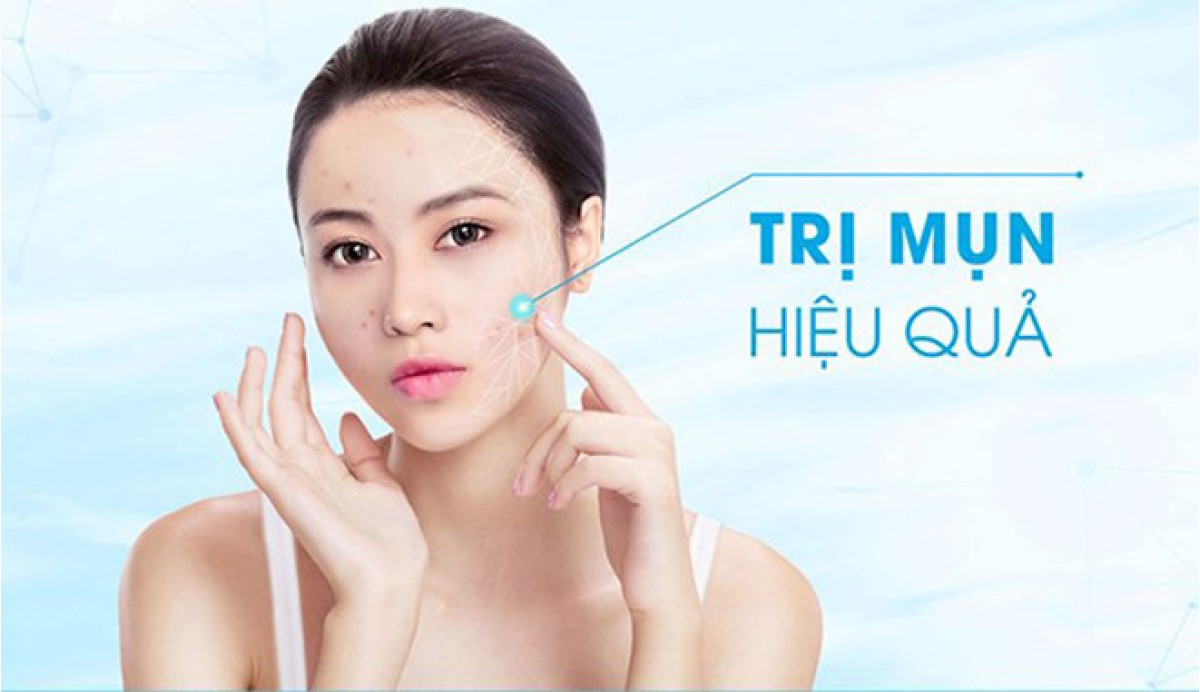 Trị mụn hiệu quả bằng dầu mu u chỉ sau 2 tuần 