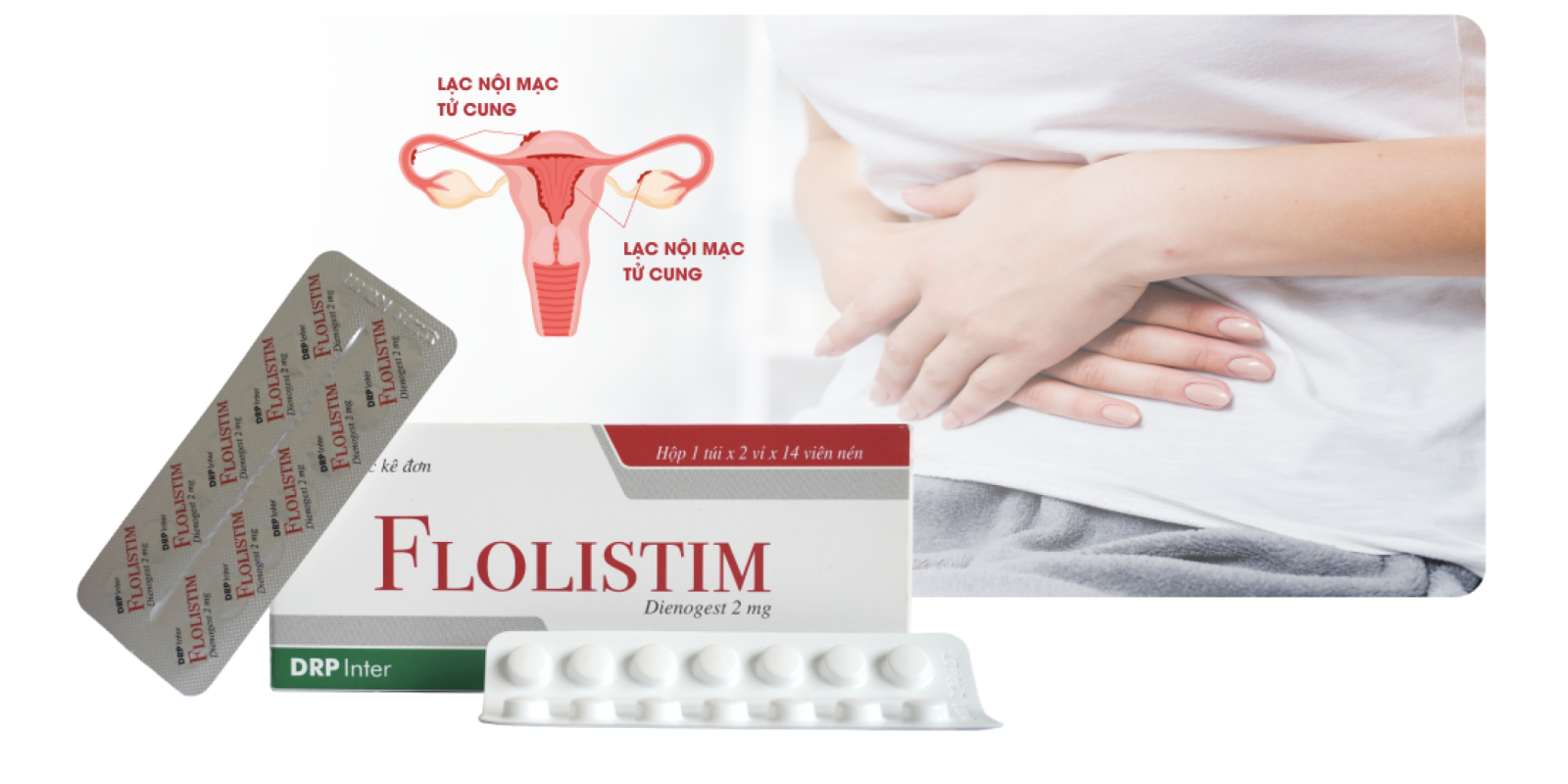 XUA TAN NỖI LO LẠC NỘI MẠC TỬ CUNG VỚI FLOLISTIM (DIENOGEST 2MG)